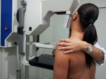 Mamografia permite deteco precoce do cncer de mama