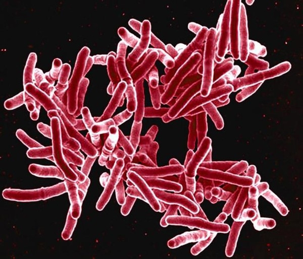 Imagem de microscopia eletrnica mostra a bactria Mycobacterium tuberculosis, que provocam tuberculose