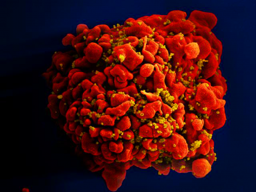 Clula infectada por partculas do vrus HIV, anexas  superfcie