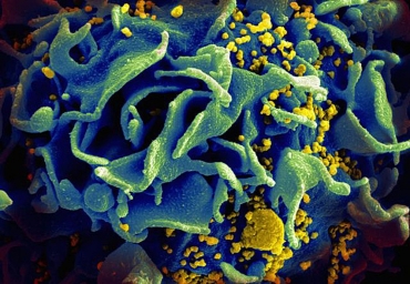 Imagem de microscpio mostra superfcie de clula do sistema imune infectada por HIV