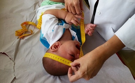 Fisioterapeuta atende bebs com microcefalia e orienta mee - Sumaia Villela/Arquivo Agncia Brasil