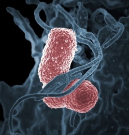 Imagem feita por microscpio eletrnico e colorizada por computador, mostrando a bactria Klebsiella pneumoniae interagindo com uma clula humana - NIAID/Direitos Reservados