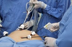Gastroplastia videolaparoscpica  opo mais utilizada no mundo para a realizao da cirurgia baritrica