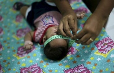 Diagnosticado com microcefalia, beb Guilherme Soares Amorim, de 2 meses, tem a cabea medida por sua me, Germana Soares, em sua casa em Ipojuca, em Pernambuco